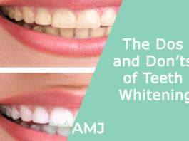 The Dos and Don’ts of Teeth Whitening
